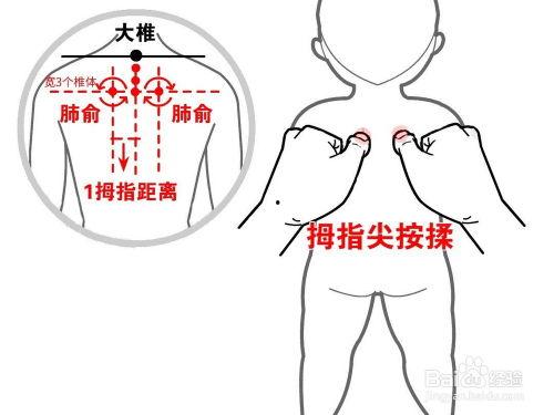 整骨手法图解视频,一图掌握骨骼复位技巧
